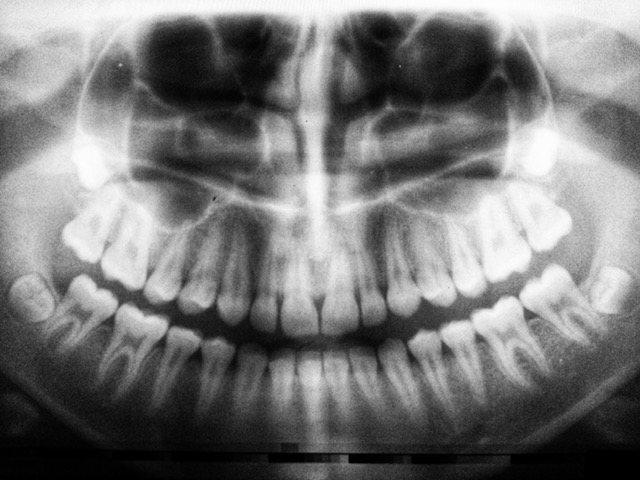 rentgen zębów Sosnowiec