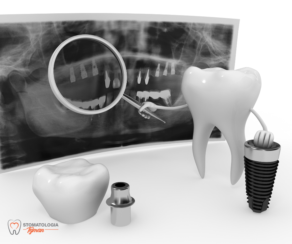 stomatolog dentysta Sosnowiec Tejman